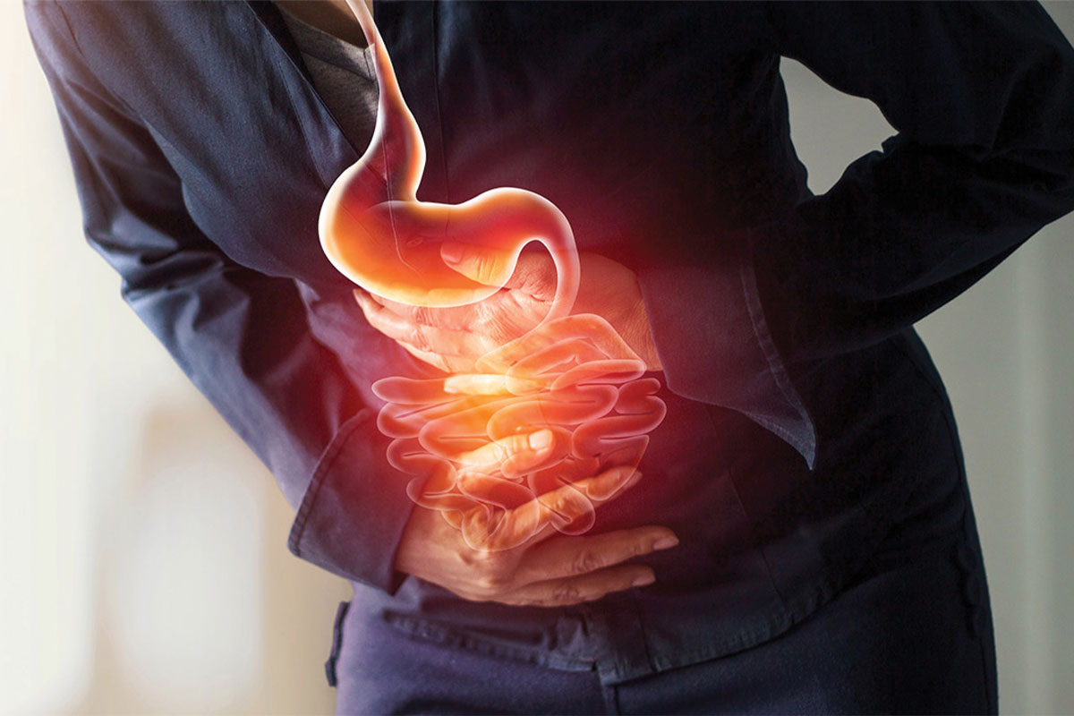 Alkalen Reflü Gastrit (Safra Gastriti)