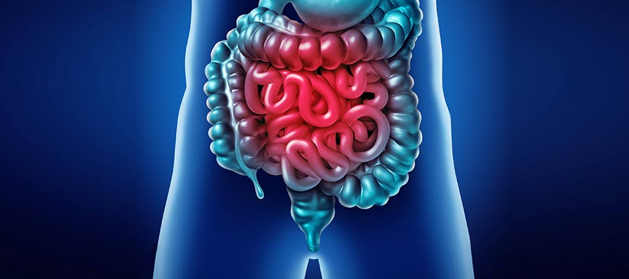 Bağırsak İltihabı