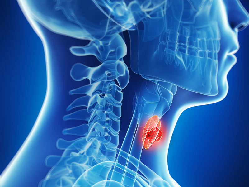 Baş ve Boyun Kanserleri